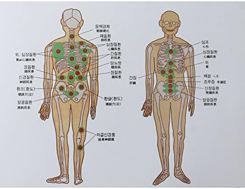[Doktor Huh] 18 Köpölyözés Meghatározott Vákuum Terápia Karcsúsító Masszázs, Akupresszúra BuHangKi Korea